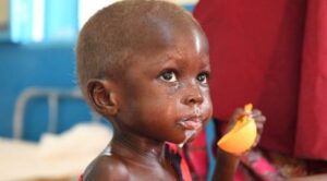 Terapeutické mléko F-100 v prášku, na přípravu 10 litrů mléka. Obsahuje syrovátku, rostlinné tuky, sacharidy a komplex minerálů a vitaminů, 10 balení, každé o hmotnosti 114 g, se před použitím ředí pitnou vodou.