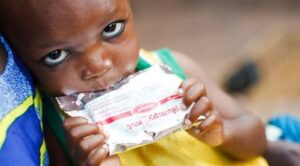 50 balení terapeutické výživy pro těžce podvyživené dítě (k úplnému vyléčení je v průměru třeba 150 balení).